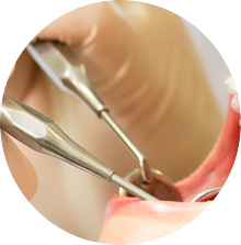 Dental Instruments